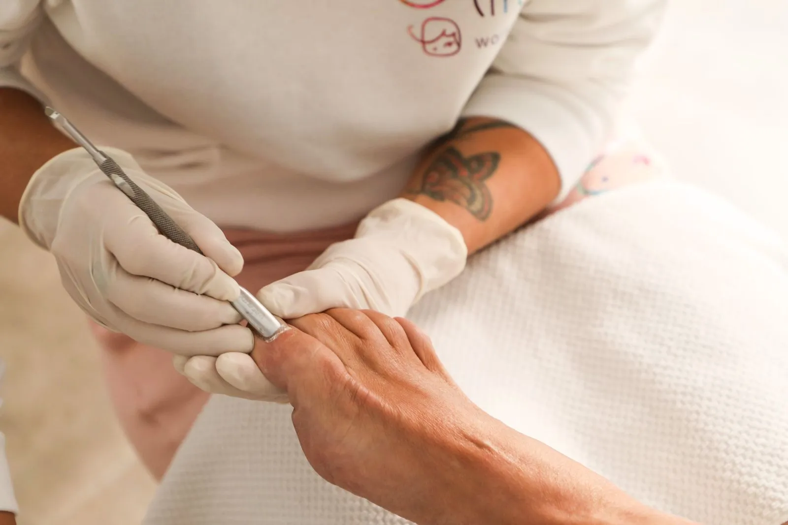 When Should You See a Podiatrist About a Bunion?